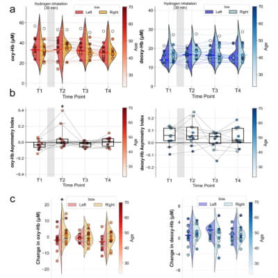 Japanese researchers observed effects of hydrogen inhalation on brain activity